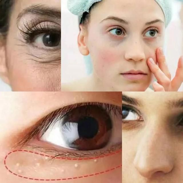 女人臉上若出現3個跡象,你比一般人要“顯老”