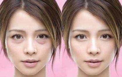 女人臉上若出現3個跡象,你比一般人要“顯老”