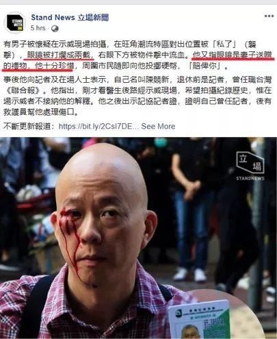 “人超好”的港籍台媒記者,也被暴徒毆打了